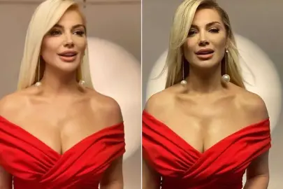 Estetik İddiaları Bitmiyor! Songül Karlı&apos;nın son hali sevenlerini şaşırttı