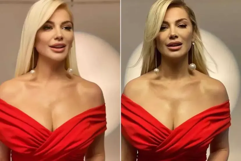 Estetik İddiaları Bitmiyor! Songül Karlı&apos;nın son hali sevenlerini şaşırttı